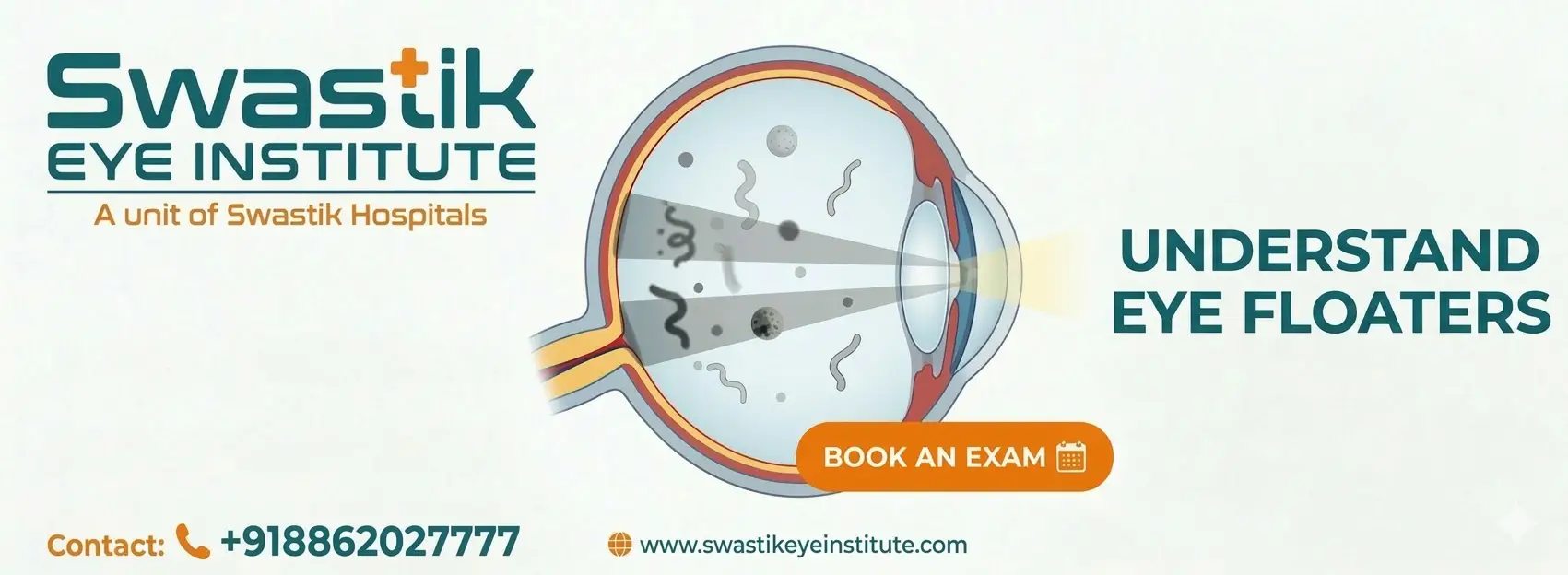 Eye Floaters: Causes, Symptoms, and Treatment featured image